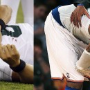 Carmelo Anthony, Mark Sanchez, and the Shoulder Labrum Injury Epidemic