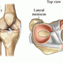 Russell Westbrook’s Knee Injury Breakdown